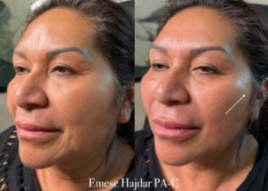 9AB34F5E-2354-4B00-ADFF-38F740C9DF53